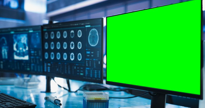 Cancer Research Center Medical Laboratory: Close Up of a Desktop Computer With Green Screen Chromakey On Display.