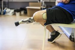 unrecognizable man amputated testing his new leg prosthesis