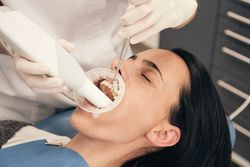 Crop stomatologist working with client teeth during 3D scanning