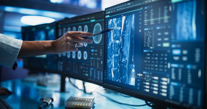 Modern Cancer Research Medical Center: Anonymous Doctor Pointing At Desktop Computer Monitor With 3D Software Visualizing Human Brain Based On CT Scan.
