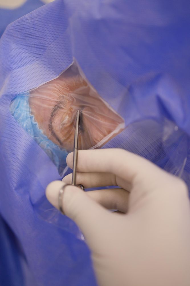 Doctor beginning to work on an eye surgery