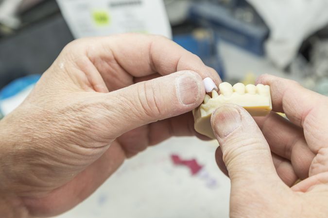 Dental Technician Working On 3D Printed Mold For Tooth Implants