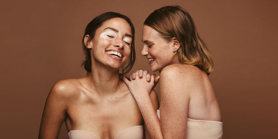 Two young women accepting of their skin imperfections