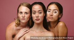 Portrait of three serious women with skin imperfections bemLPb