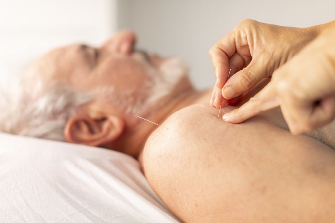 The hands of a physiotherapist placing needles on the shoulder of an older man, during an acupuncture session