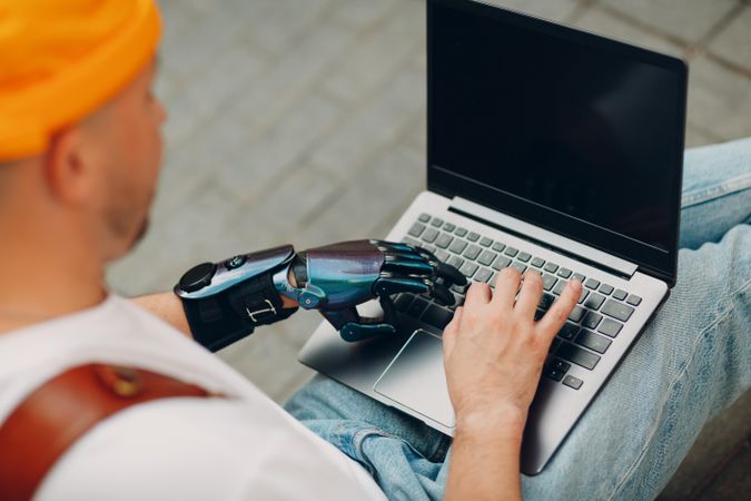 Back view of a man with prosthetic hand using laptop