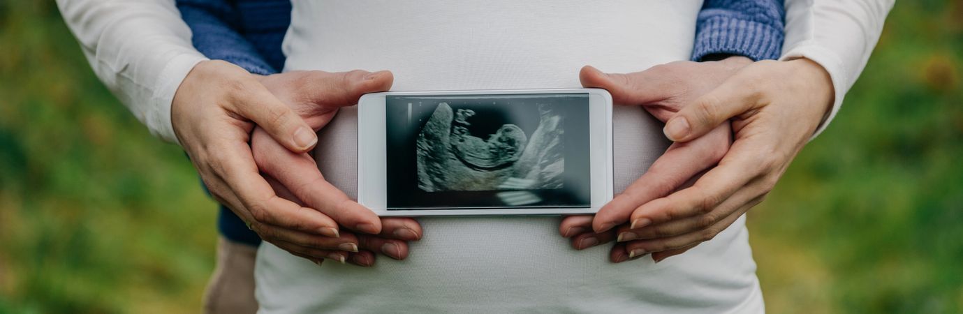 Man showing ultrasound over his wife's belly