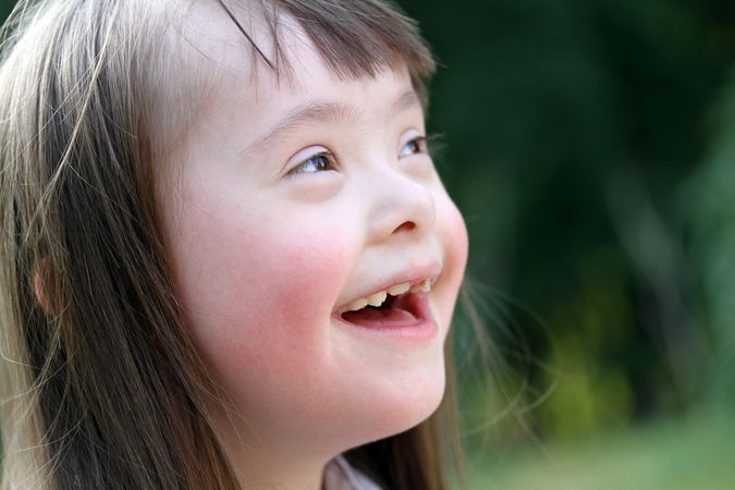 Closeup of a young brunette girl with an intellectual disability
