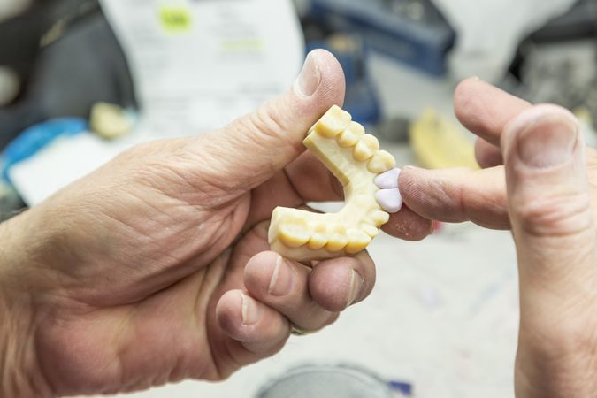 Dental Technician Working On 3D Printed Mold For Tooth Implants