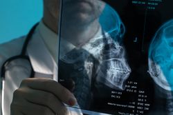 Doctor examining skull X-ray film