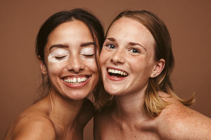 Naturally beautiful women with unique skin imperfections