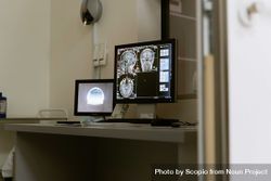 Computer screen showcasing MRI results 5QXgE0