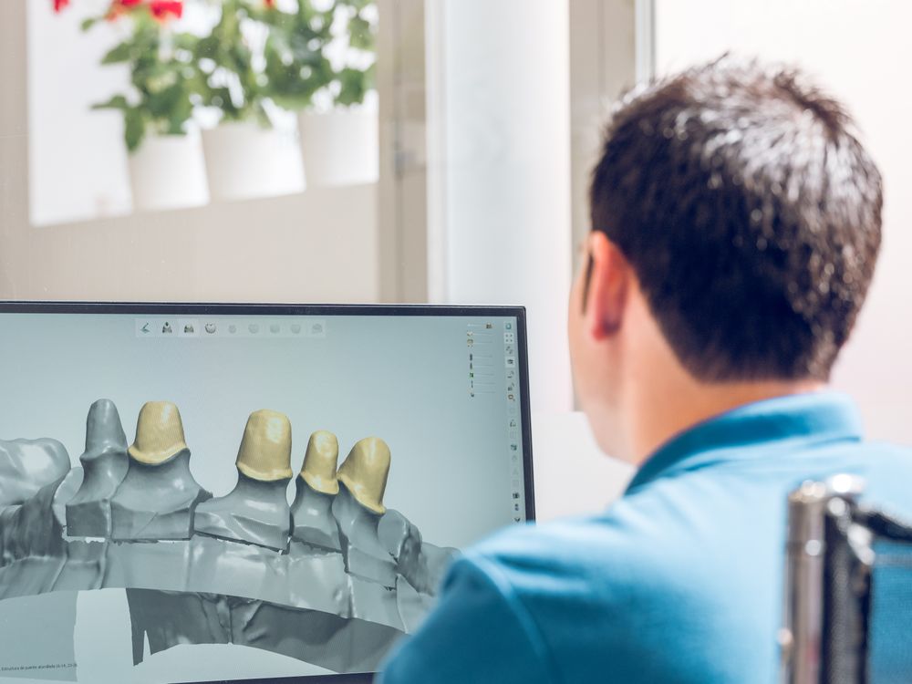 Male dentist checking 3d model of dental implants in computer