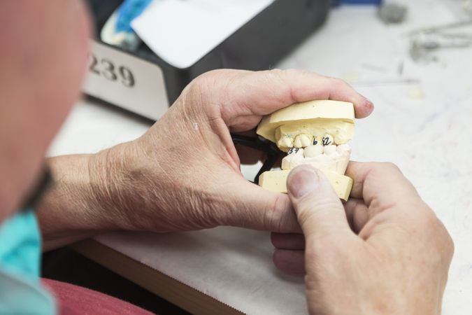 Dental Technician Working On 3D Printed Mold For Tooth Implants