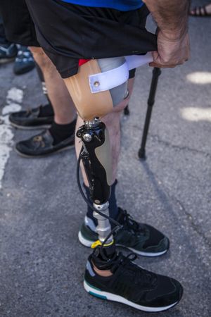 Unrecognizable young man amputated with his leg prosthesis