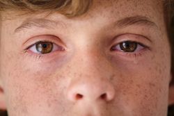 Crop crying child with freckles on face skin