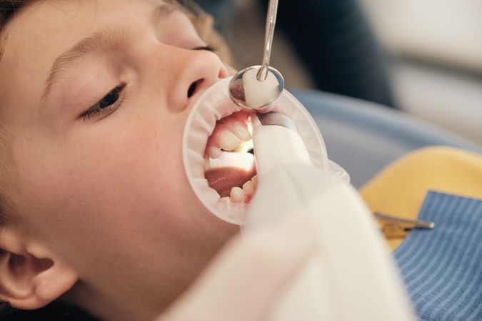 Faceless dentist scanning teeth of boy