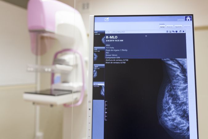 Modern digital mammography unit at clinic
