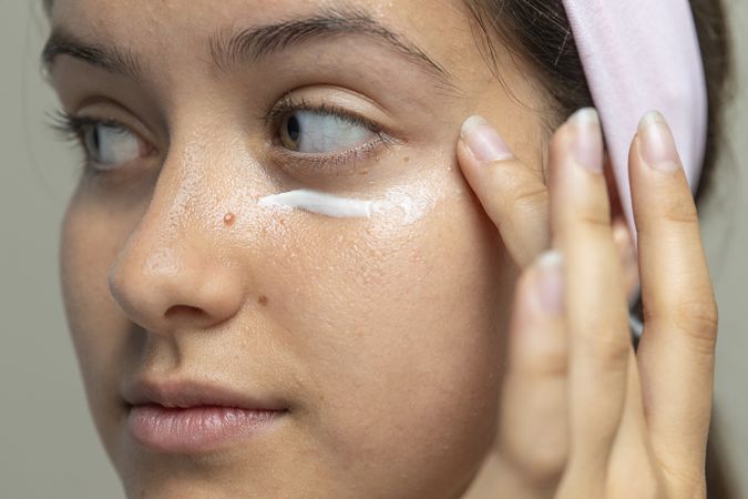 Macro of a woman applying a medicated cream for acne or blemish treatment