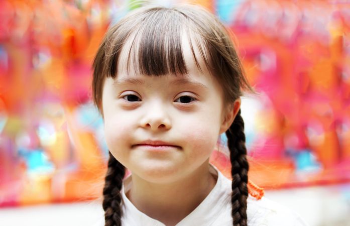 Portrait of young girl with Down syndrome with a serious expression
