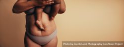 Cropped shot of woman’s postpartum body with stretch marks 4OMpv0