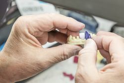 Dental Technician Working On 3D Printed Mold For Tooth Implants
