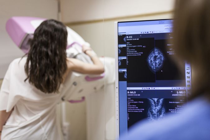 Female patient beside digital mammography unit