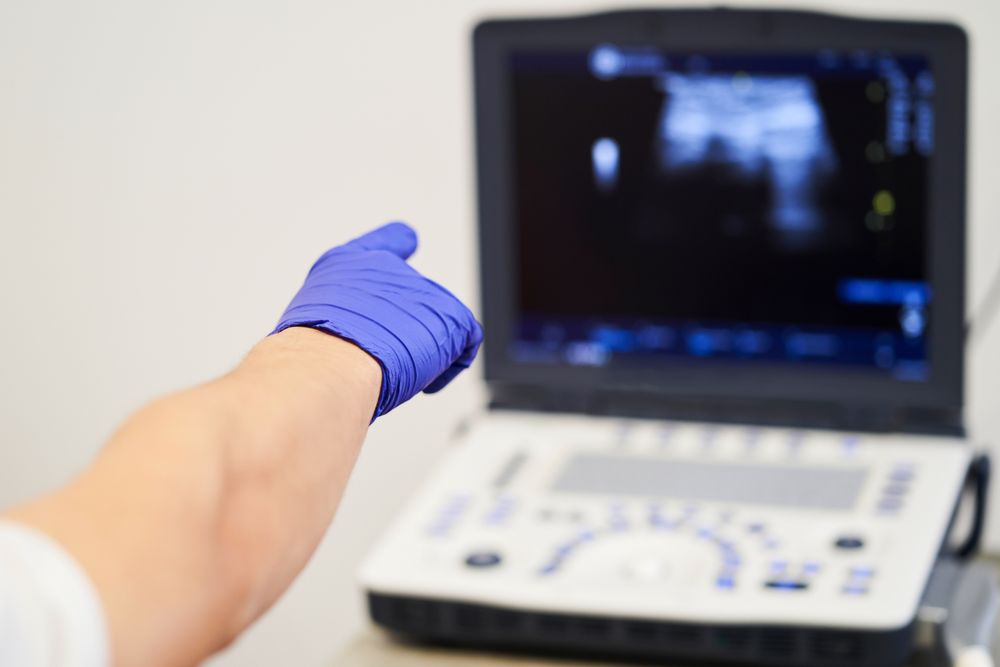 ultrasound scan at the fertility clinic.