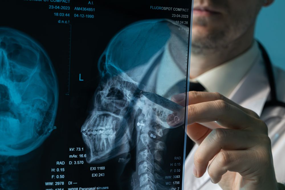 Doctor analyzing skull X-ray with stylus