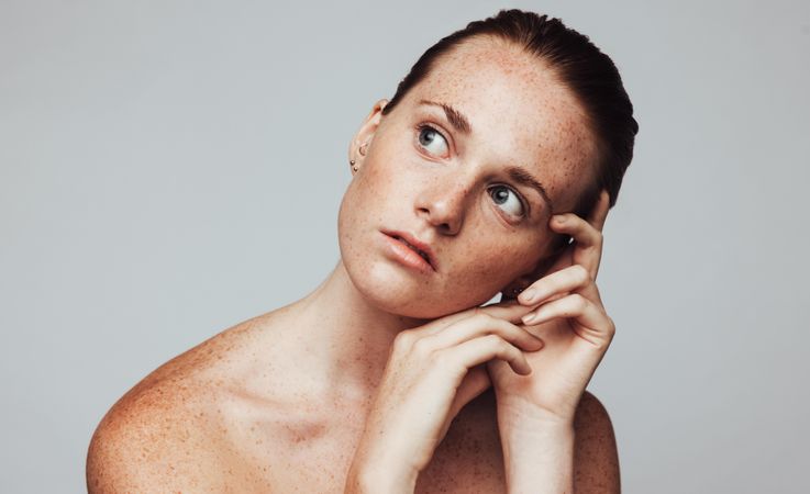 Skin-positive woman with real freckles on her face and body