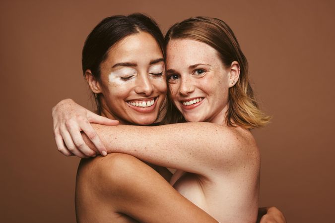 Two young women with beautiful skin holding each other in arms