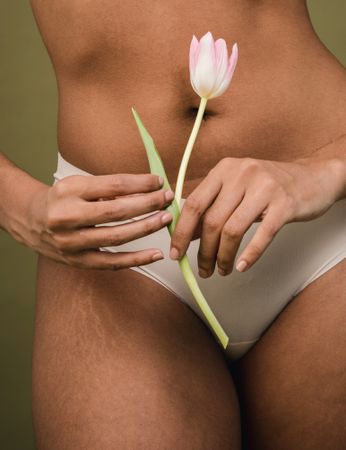 Cropped image of beautiful woman's hip with stretch mark