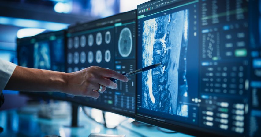 Modern Medical Research Center: Anonymous Doctor Pointing At Desktop Computer Monitor With Software Visualizing Human Brain Based On MRI Scan.