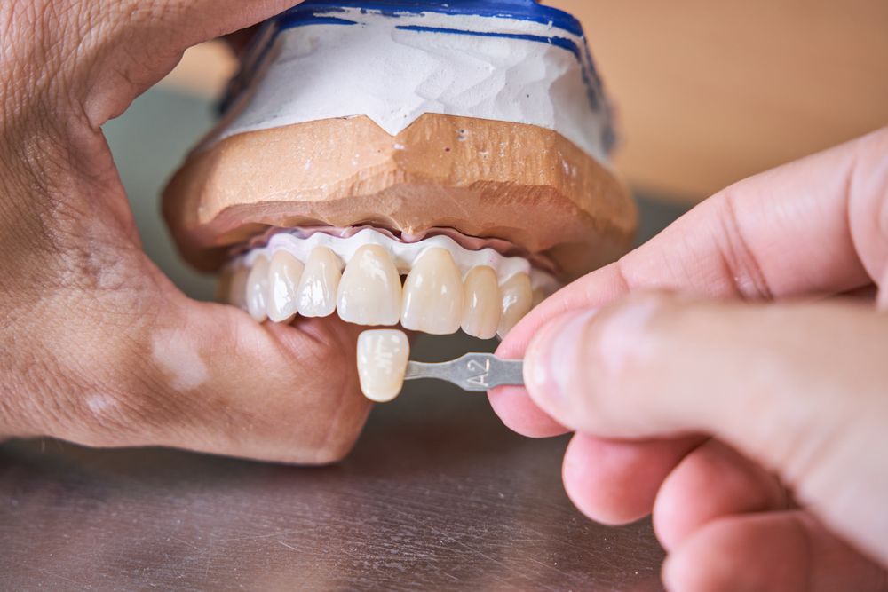 Crop male orthodontist in process of making veneers