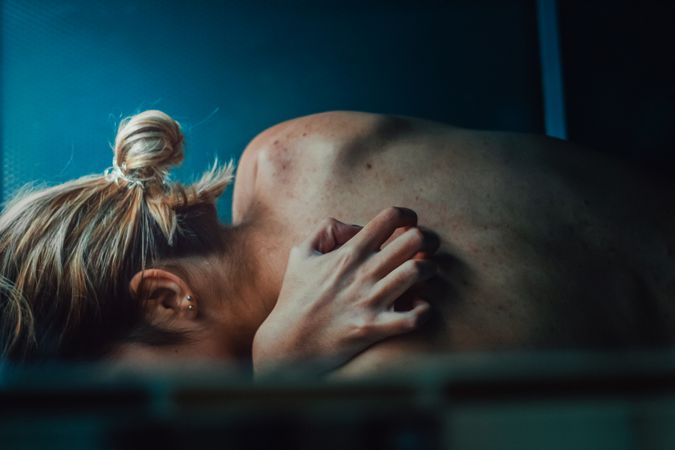 Portrait of a woman’s back with acne