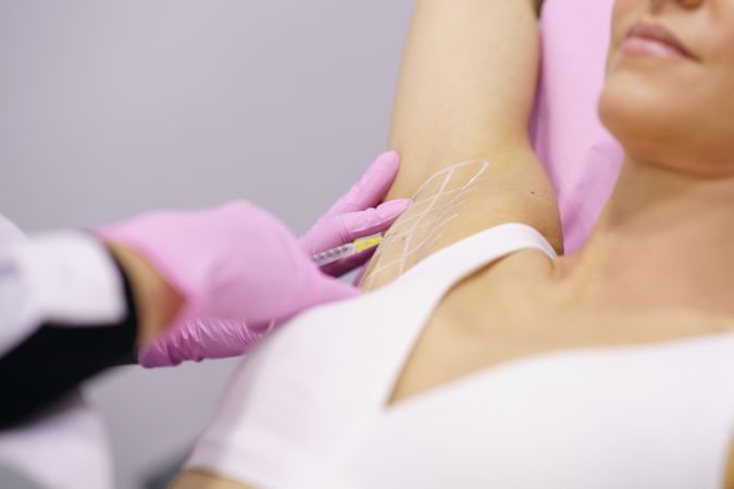 Woman lying down having her under arm injected for hyperhidrosis treatment