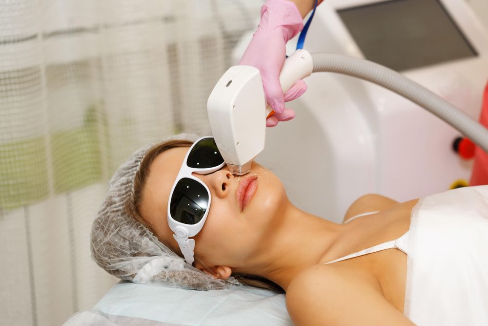Female with laser hair tool working on upper lip