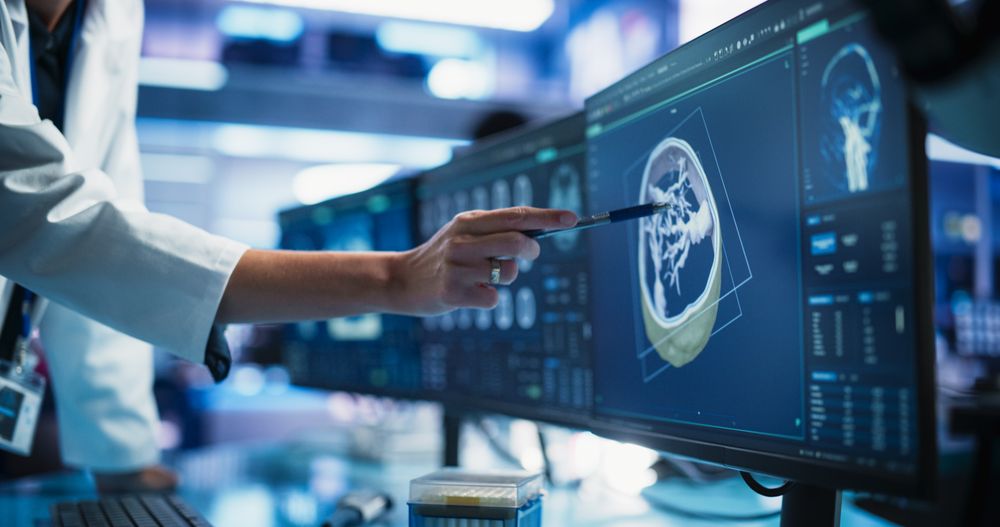 Modern Cancer Research Medical Center: Anonymous Doctor Pointing At Desktop Computer Monitor With 3D Software Visualizing Human Brain Based On CT Scan.