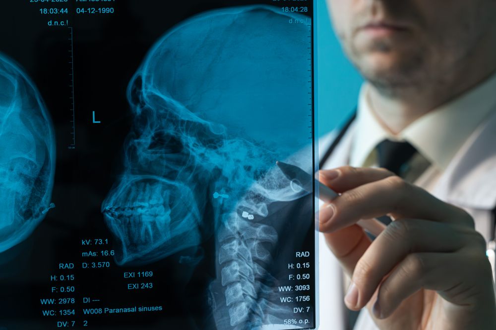 Doctor analyzing skull X-ray with stylus