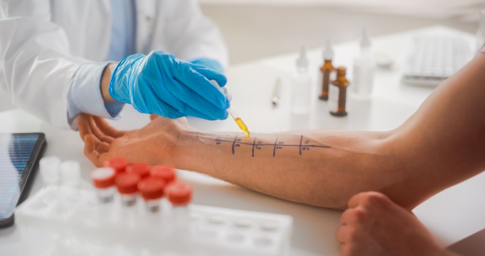 Close Up of a Patient Passing a Prick Scratch Allergy Test.