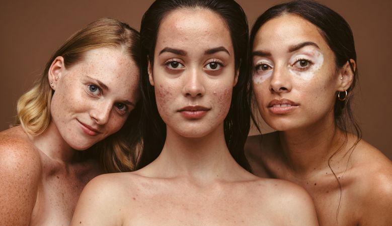 Group of beautiful women with natural clean skin