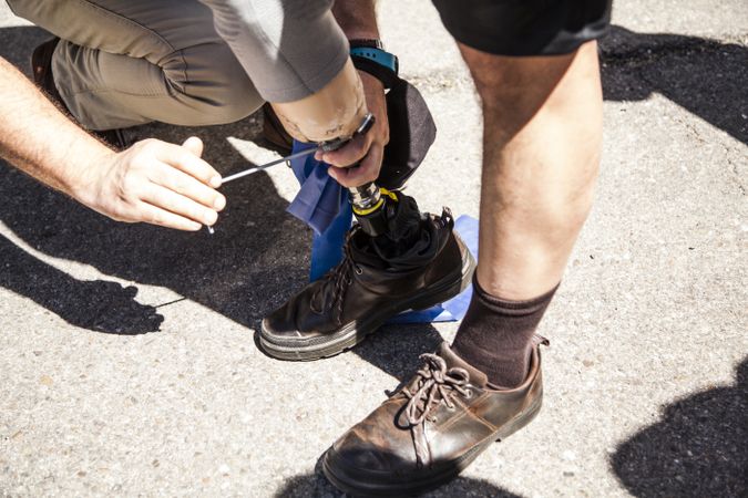 man helping amputated young man testing the new leg prosthesis
