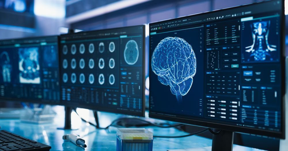 Cancer Research Center Medical Laboratory: Close Up of a Set of Desktop Computer Monitors Showing CT Scans Of Human Brain.
