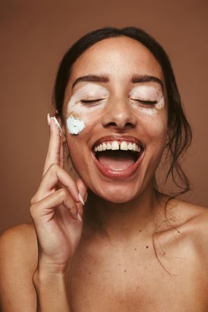 Portrait of young woman with vitiligo applying cream on cheek