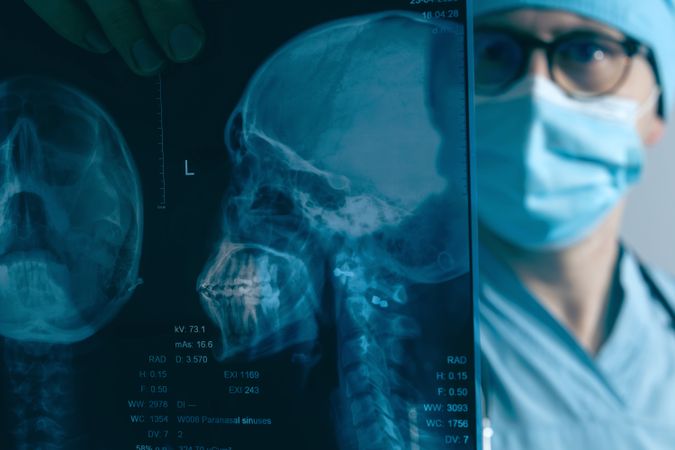 Doctor examining skull X-ray film