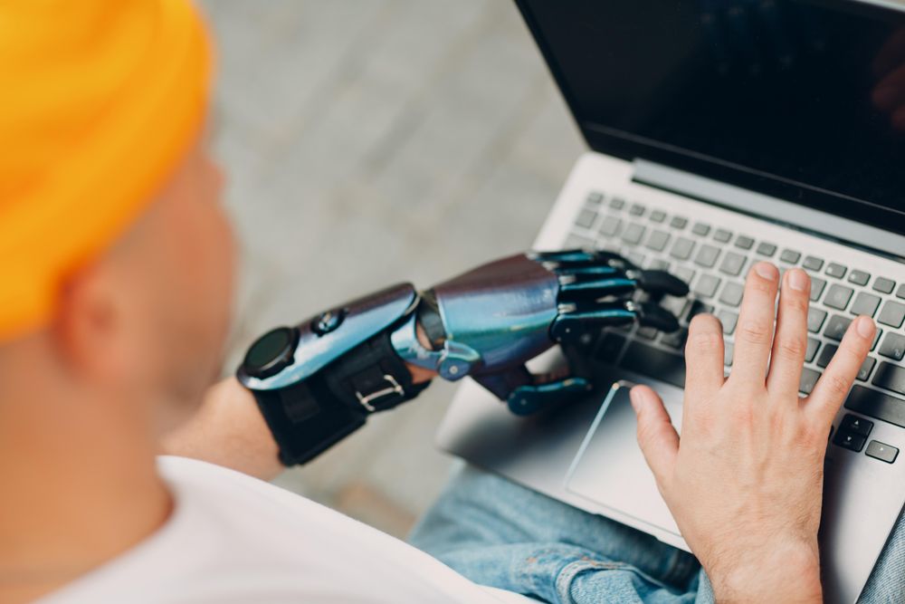 Man with prosthetic hand typing on a computer