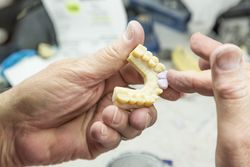 Dental Technician Working On 3D Printed Mold For Tooth Implants