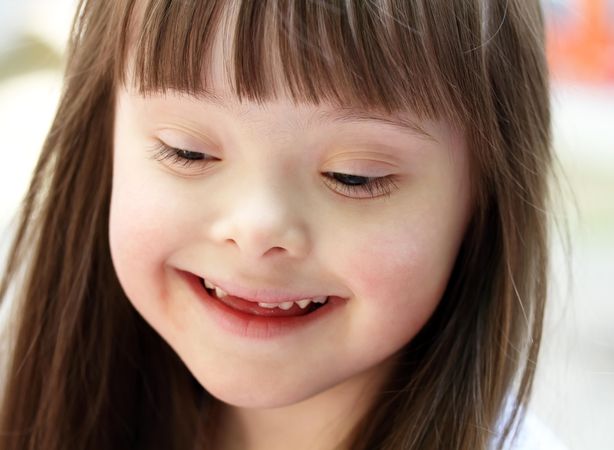 Portrait of a young girl with Down syndrome looking down