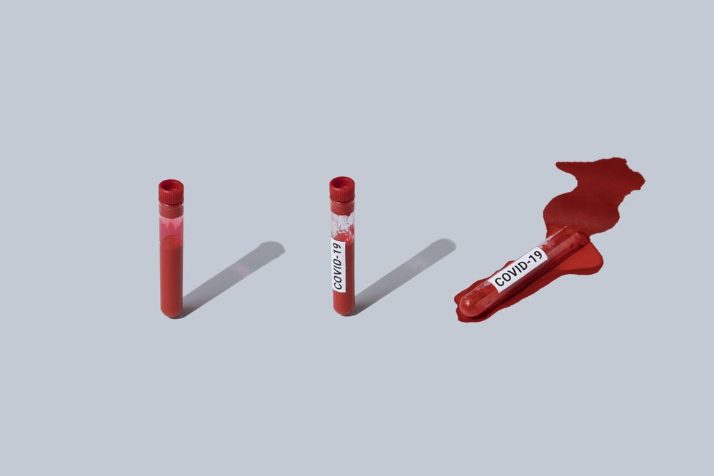 Row of 3 vials of blood labelled with “COVID-19” with one spilled on light background