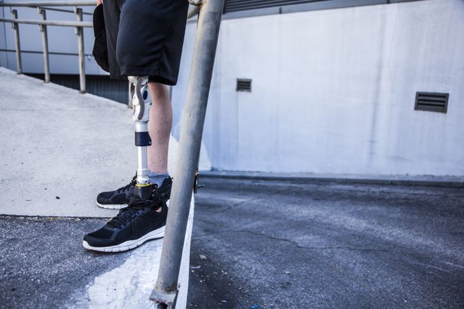 Unrecognizable young man amputated with his leg prosthesis